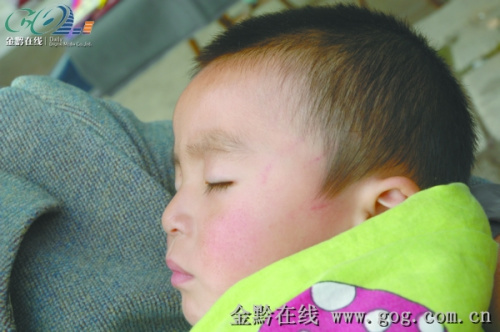 幼兒園女老師扇兩歲半幼兒耳光稱心情不好(圖)